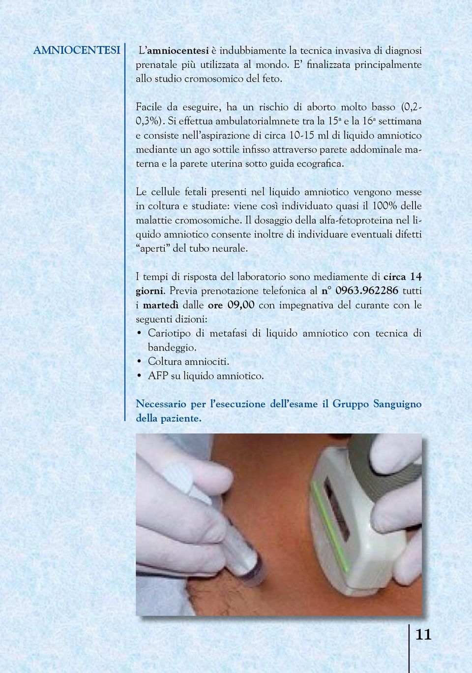 Si effettua ambulatorialmnete tra la 15 a e la 16 a settimana e consiste nell aspirazione di circa 10-15 ml di liquido amniotico mediante un ago sottile infisso attraverso parete addominale materna e