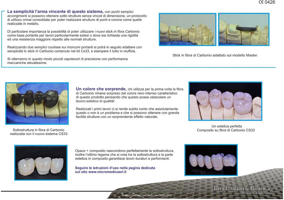 Di particolare importanza la possibilità di poter utilizzare i nuovi stick in fibra Carbonio come base portante per lavori particolarmente estesi o dove sia richiesta una rigidità ed una resistenza