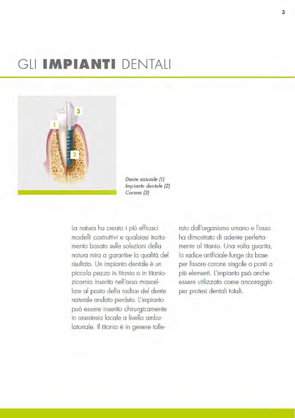 L'impianto può essere inserito chirurgicamente in anestesia locale a livello ambulatoriale.