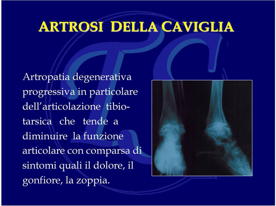 tende a diminuire la funzione articolare con