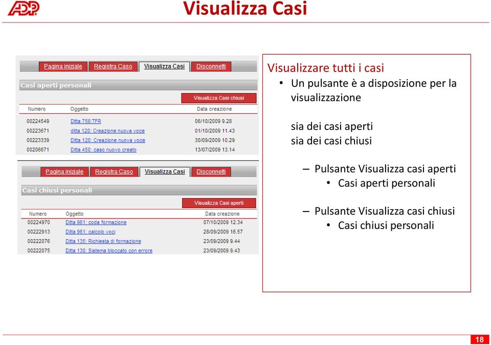 dei casi chiusi Pulsante Visualizza casi aperti Casi aperti