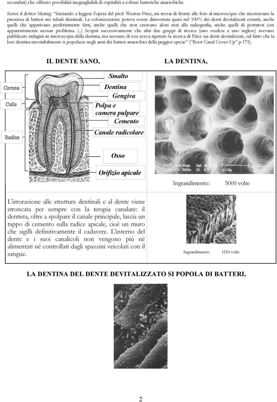 La colonizzazione poteva essere dimostrata quasi nel 100% dei denti devitalizzati estratti, anche quelli che apparivano perfettamente fatti, anche quelli che non creavano aloni neri alla radiografia,