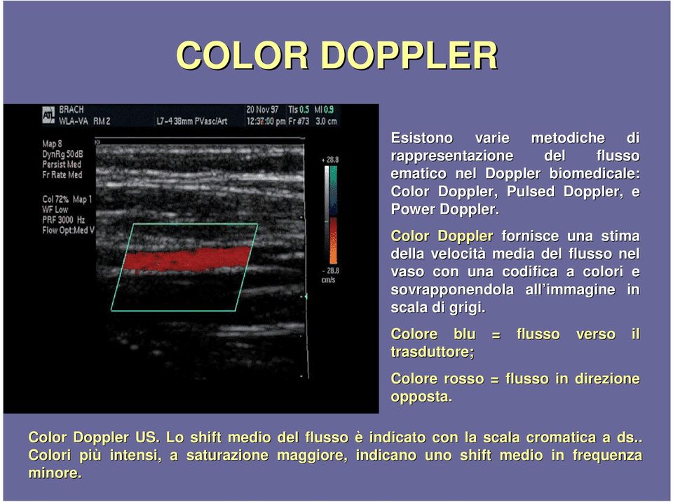 Color Doppler fornisce una stima della velocità media del flusso nel vaso con una codifica a colori e sovrapponendola all immagine in scala