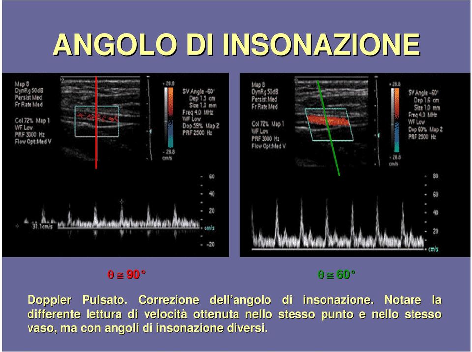 . Notare la differente lettura di velocità ottenuta