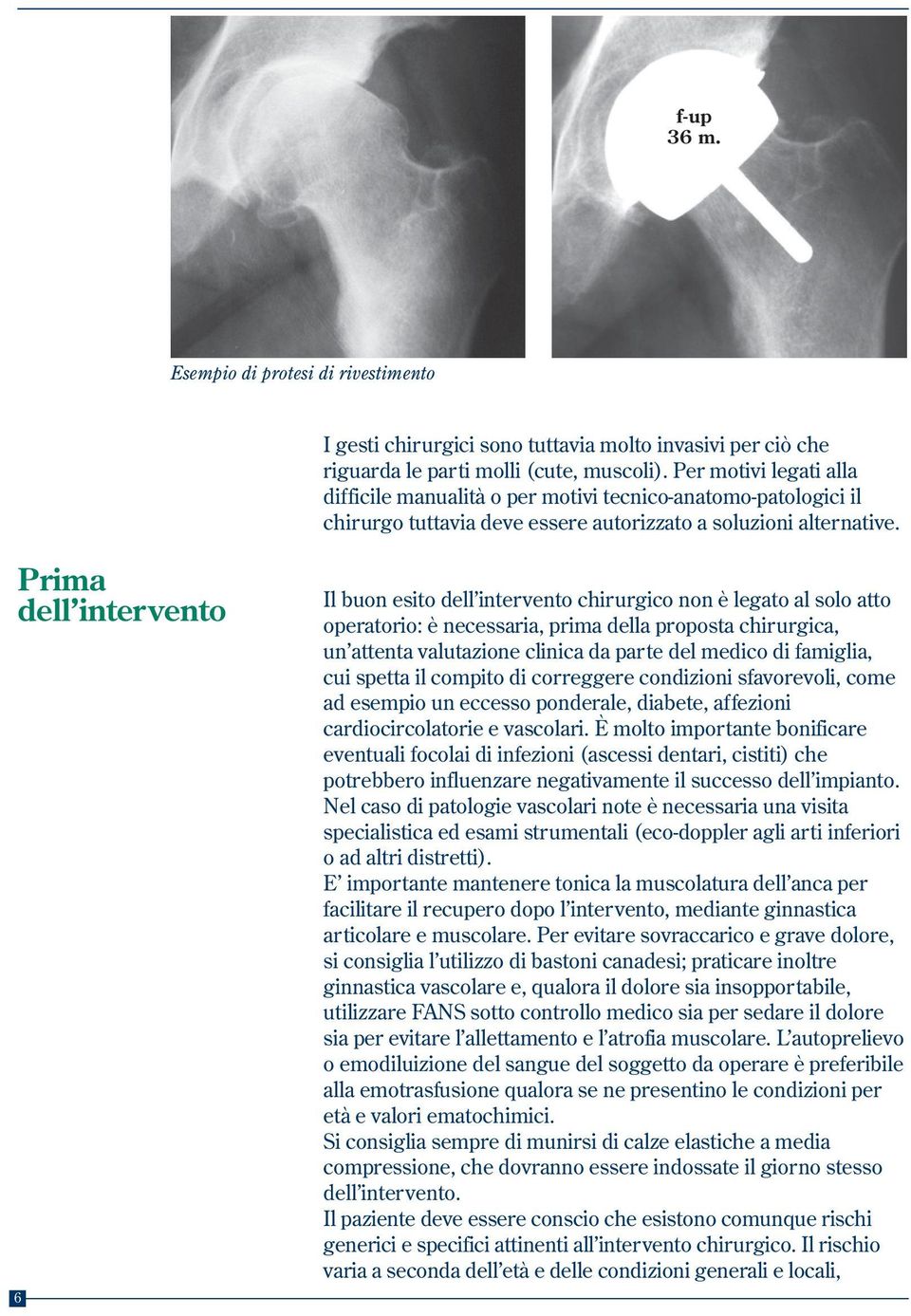 Prima dell intervento 6 Il buon esito dell intervento chirurgico non è legato al solo atto operatorio: è necessaria, prima della proposta chirurgica, un attenta valutazione clinica da parte del