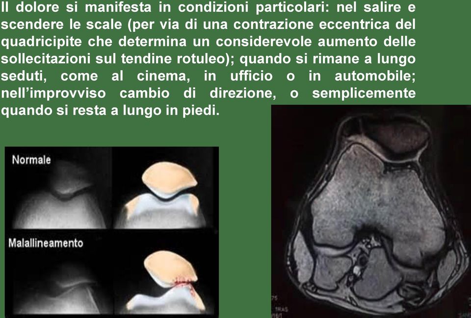 sollecitazioni sul tendine rotuleo); quando si rimane a lungo seduti, come al cinema, in