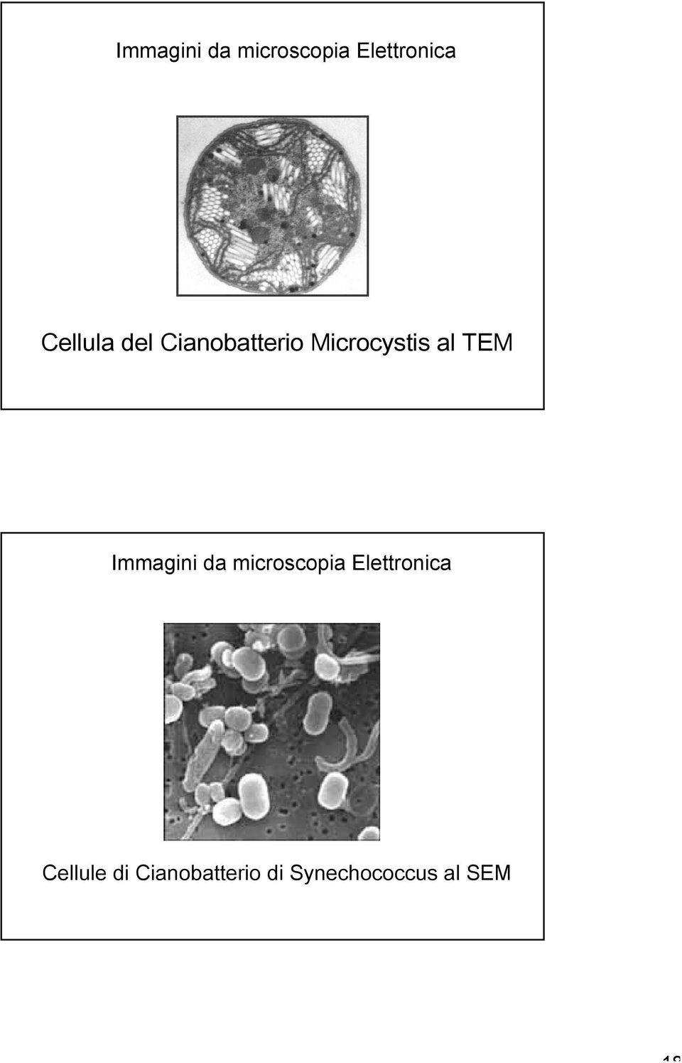 TEM  Cellule di Cianobatterio di