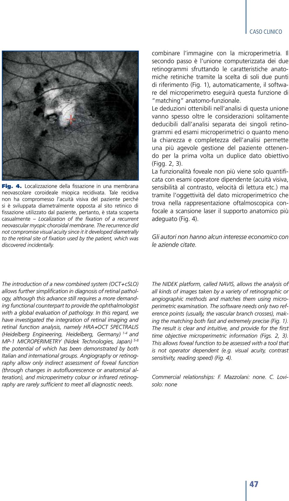 casualmente Localization of the fixation of a recurrent neovascular myopic choroidal membrane.