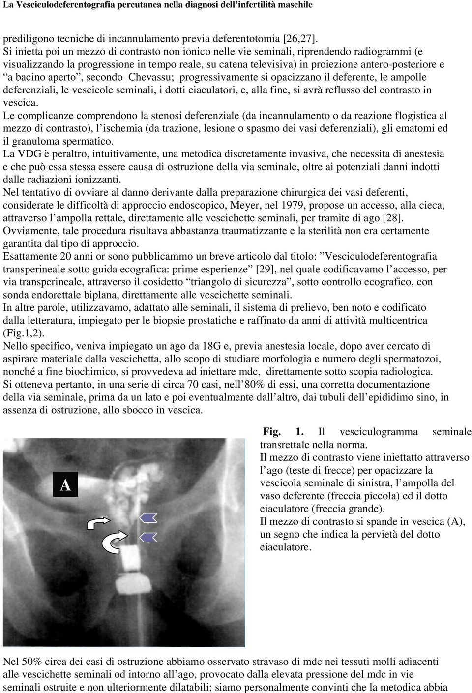 bacino aperto, secondo Chevassu; progressivamente si opacizzano il deferente, le ampolle deferenziali, le vescicole seminali, i dotti eiaculatori, e, alla fine, si avrà reflusso del contrasto in