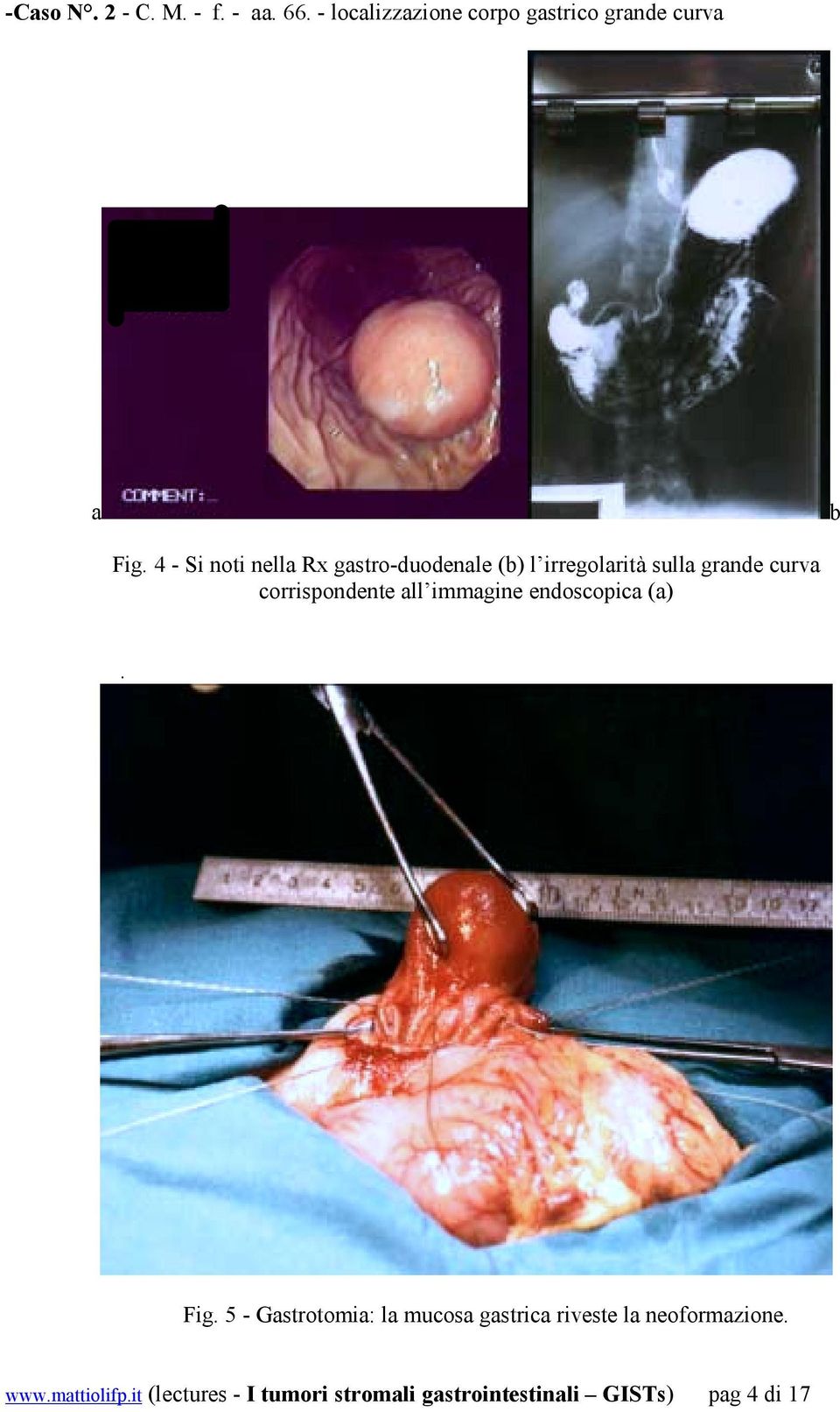 corrispondente all immagine endoscopica (a). Fig.