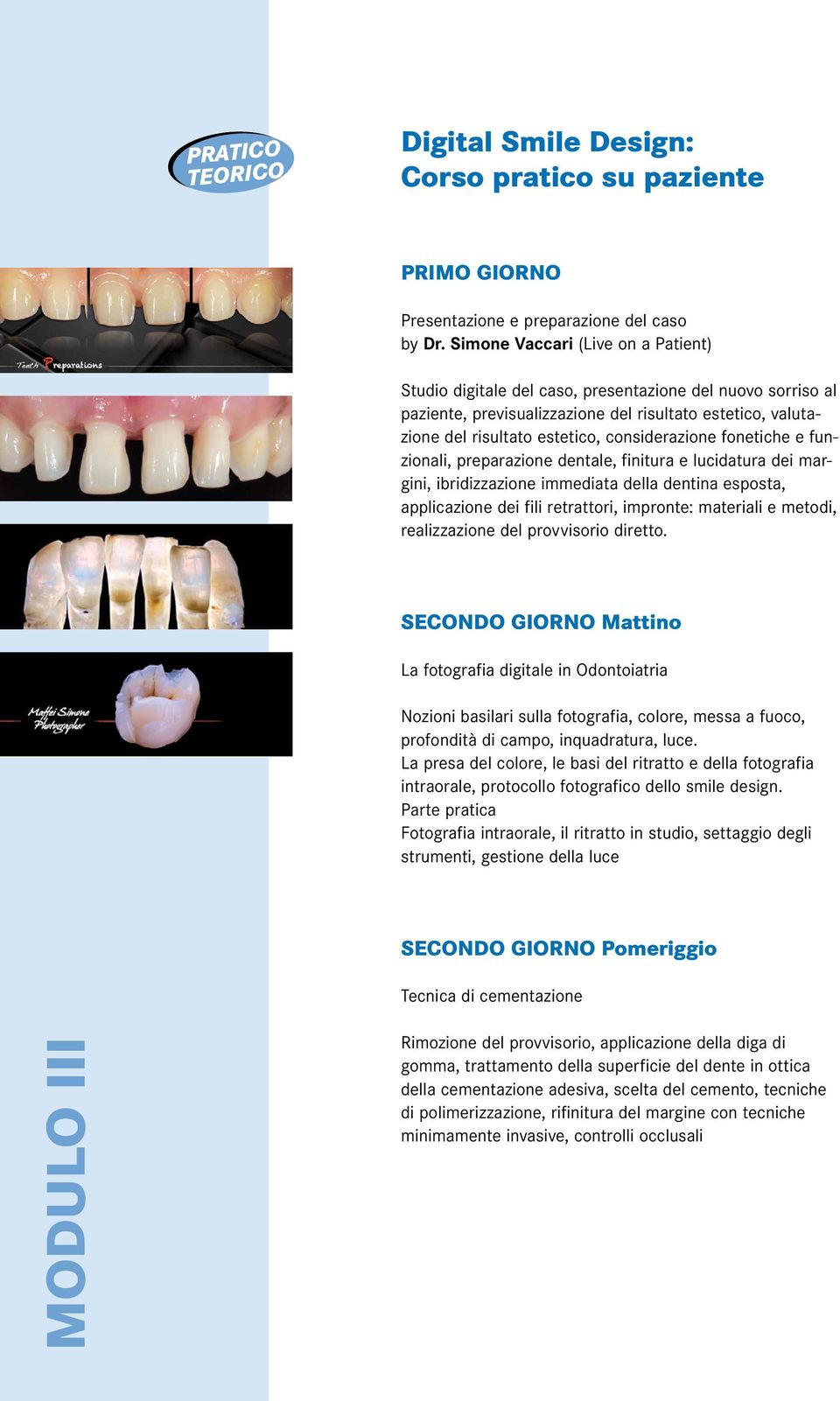 fonetiche e funzionali, preparazione dentale, finitura e lucidatura dei margini, ibridizzazione immediata della dentina esposta, applicazione dei fili retrattori, impronte: materiali e metodi,