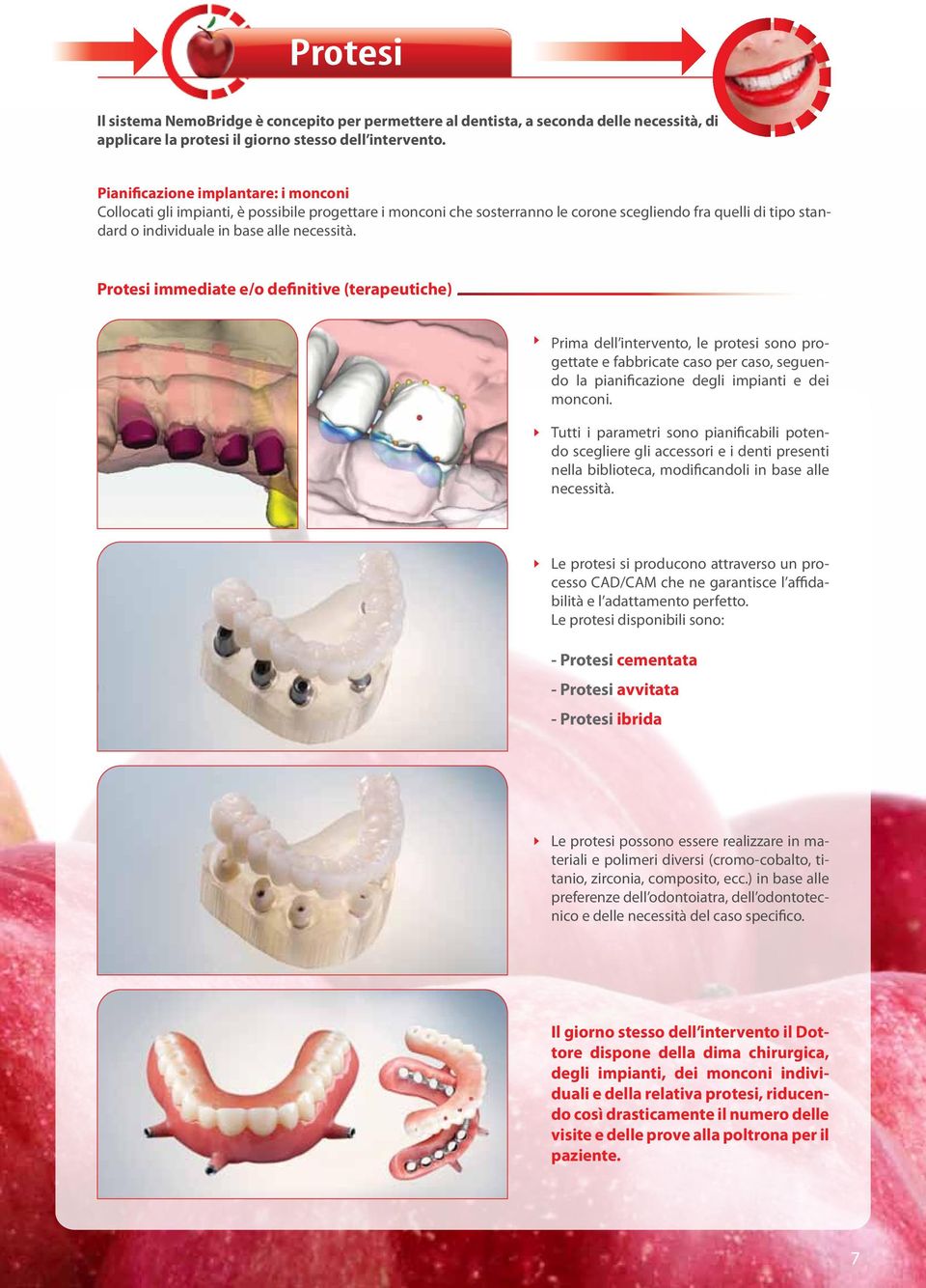 Protesi immediate e/o definitive (terapeutiche) Prima dell intervento, le protesi sono progettate e fabbricate caso per caso, seguendo la pianificazione degli impianti e dei monconi.
