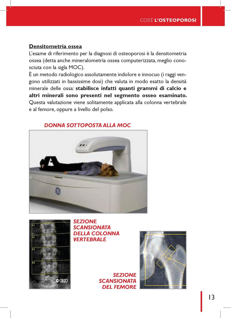 È un metodo radiologico assolutamente indolore e innocuo (i raggi vengono utilizzati in bassissime dosi) che valuta in modo esatto la densità minerale delle ossa: