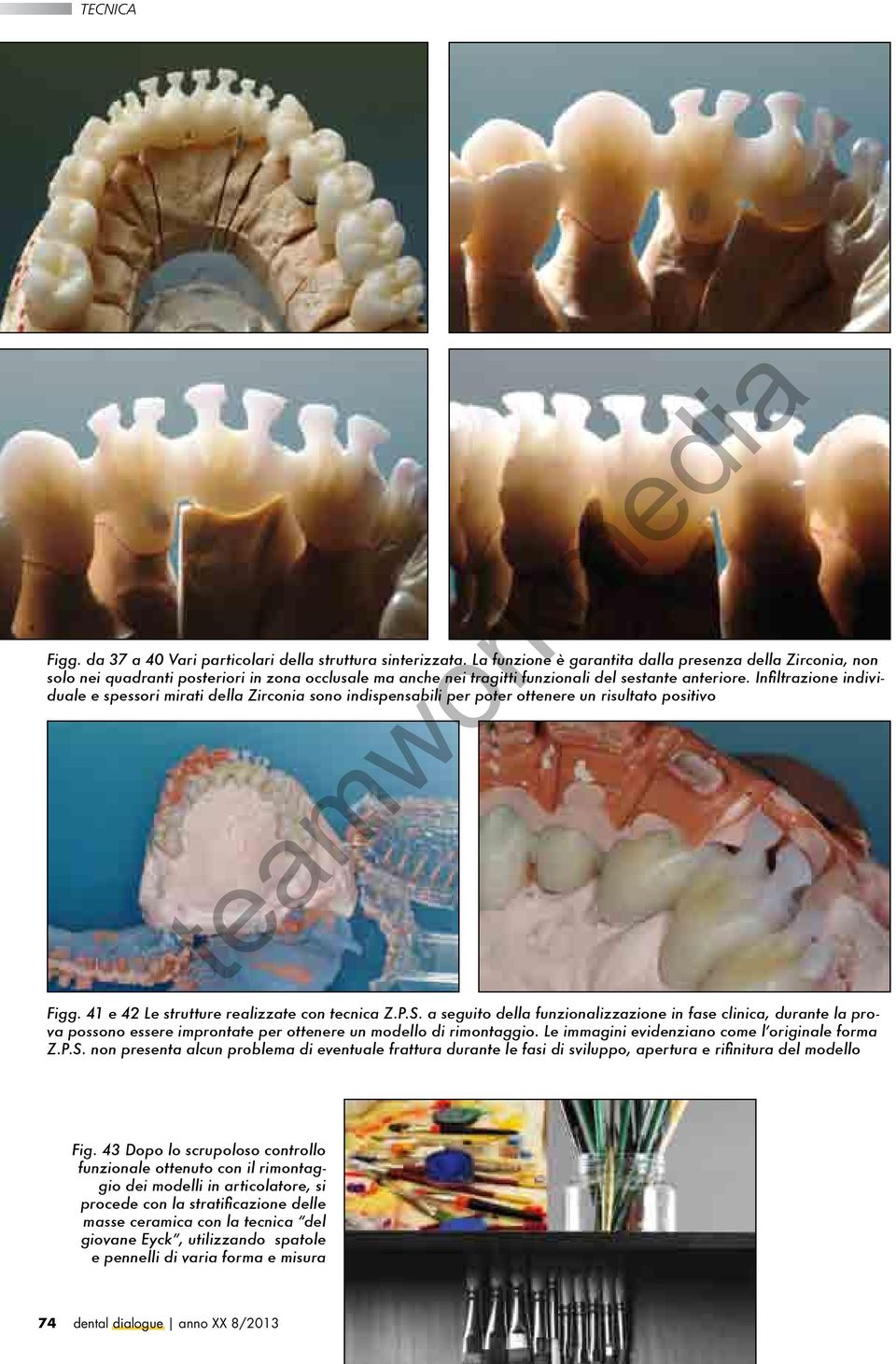 Infiltrazione individuale e spessori mirati della Zirconia sono indispensabili per poter ottenere un risultato positivo Figg. 41 e 42 Le strutture realizzate con tecnica Z.P.S.