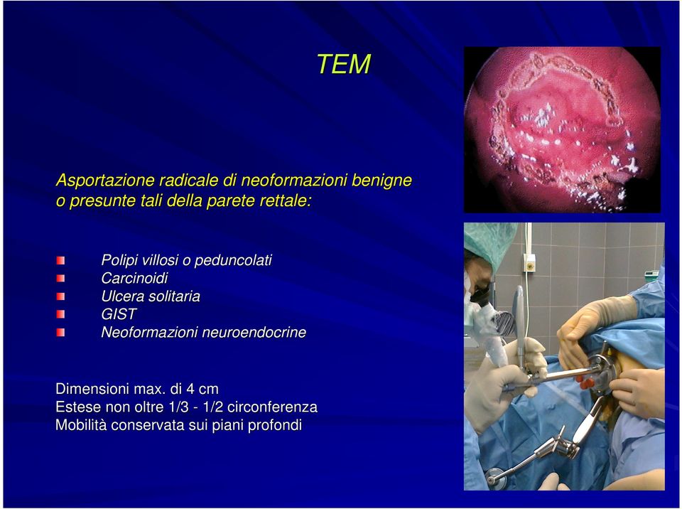 solitaria GIST Neoformazioni neuroendocrine Dimensioni max.