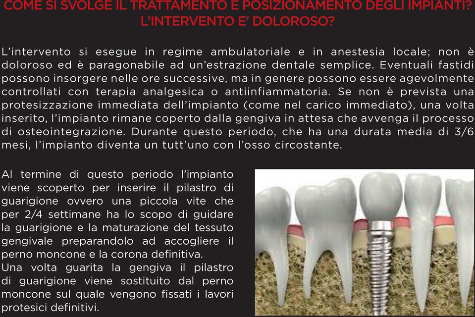 Eventuali fastidi possono insorgere nelle ore successive, ma in genere possono essere agevolmente controllati con terapia analgesica o antiinfiammatoria.