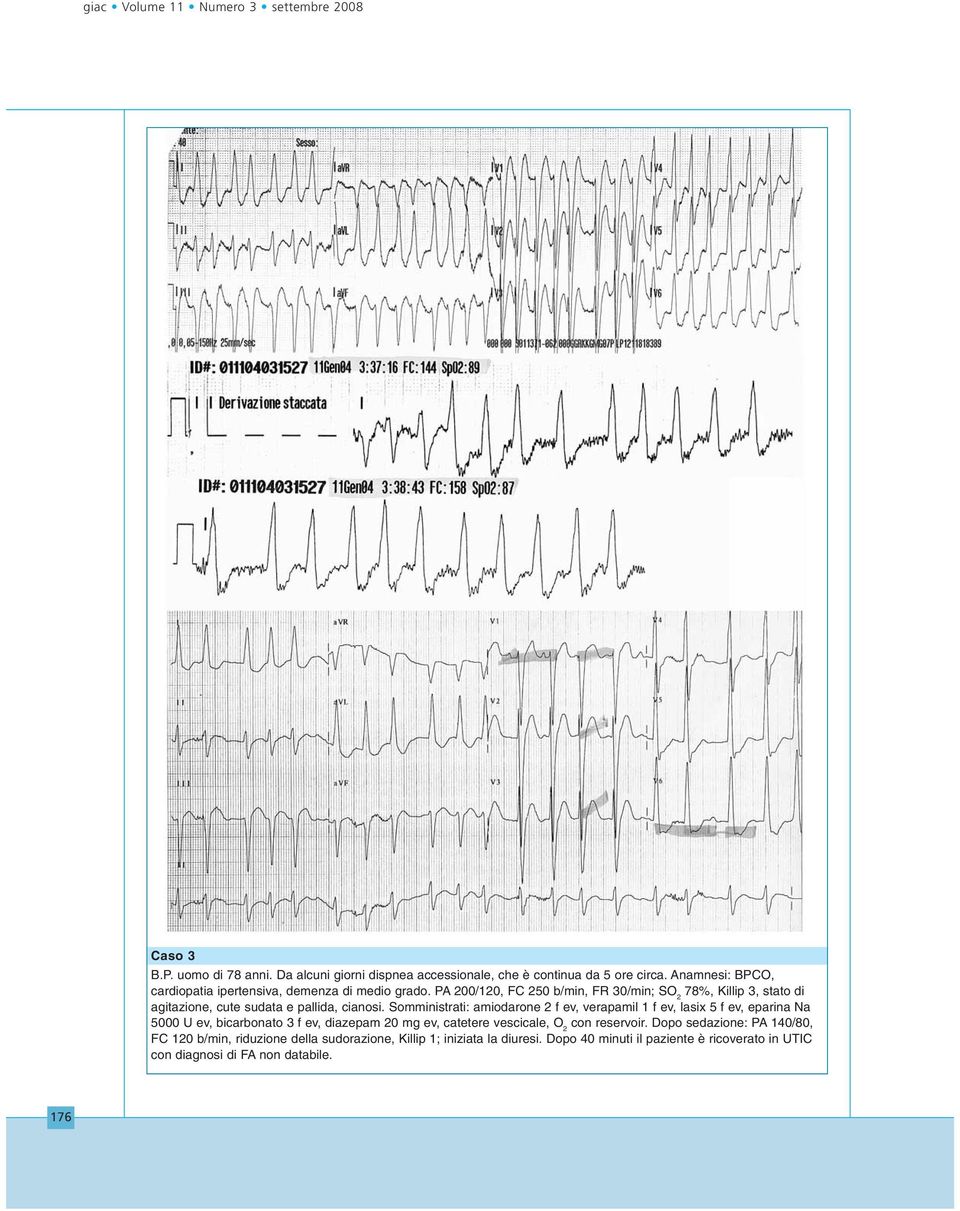 PA 200/120, FC 250 b/min, FR 30/min; SO 2 78%, Killip 3, stato di agitazione, cute sudata e pallida, cianosi.