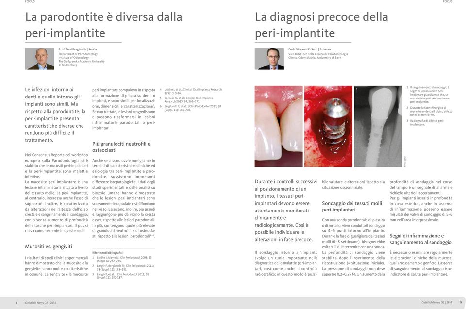 Salvi Svizzera Vice Direttore della Clinica di Parodontologia Clinica Odontoiatrica University of Bern Le infezioni intorno ai denti e quelle intorno gli impianti sono simili.