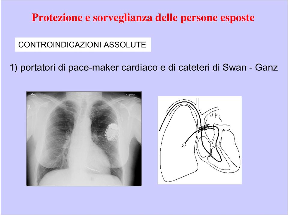 ASSOLUTE 1) portatori di