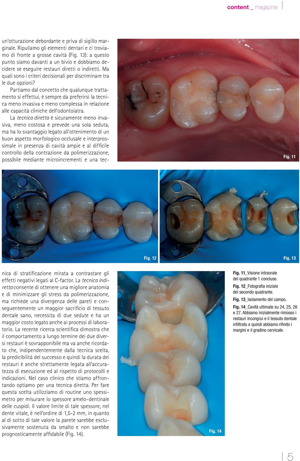 Partiamo dal concetto che qualunque trattamento si effettui, è sempre da preferirsi la tecnica meno invasiva e meno complessa in relazione alle capacità cliniche dell odontoiatra.