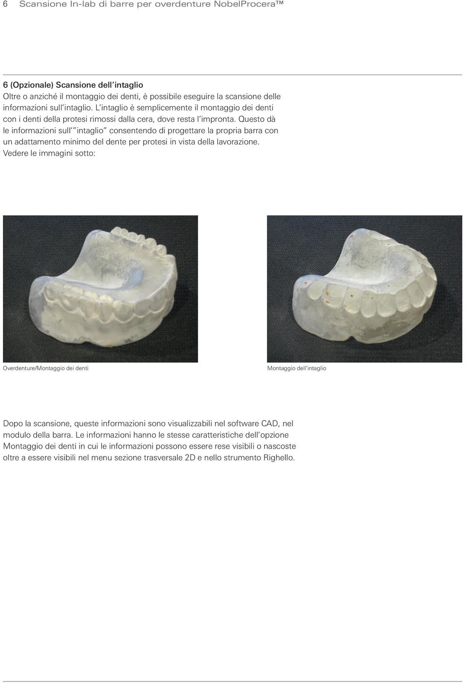 Questo dà le informazioni sull intaglio consentendo di progettare la propria barra con un adattamento minimo del dente per protesi in vista della lavorazione.