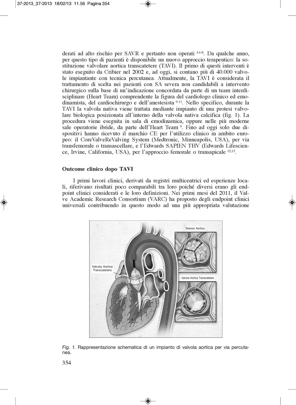 Il primo di questi interventi è stato eseguito da Cribier nel 2002 e, ad oggi, si contano più di 40.000 valvole impiantante con tecnica percutanea.