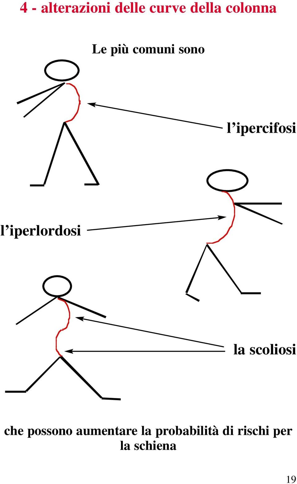 l iperlordosi la scoliosi che possono