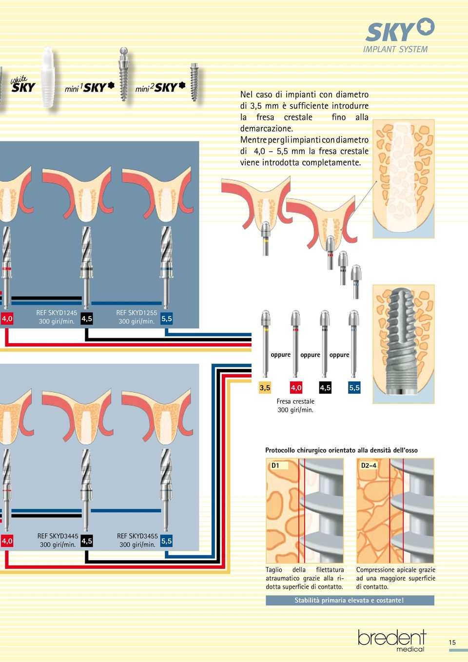 5,5 oppure oppure oppure 3,5 4,0 4,5 5,5 Fresa crestale 300 giri/min. Protocollo chirurgico orientato alla densità dell osso D1 D2-4 REF SKYD3445 4,0 300 giri/min.