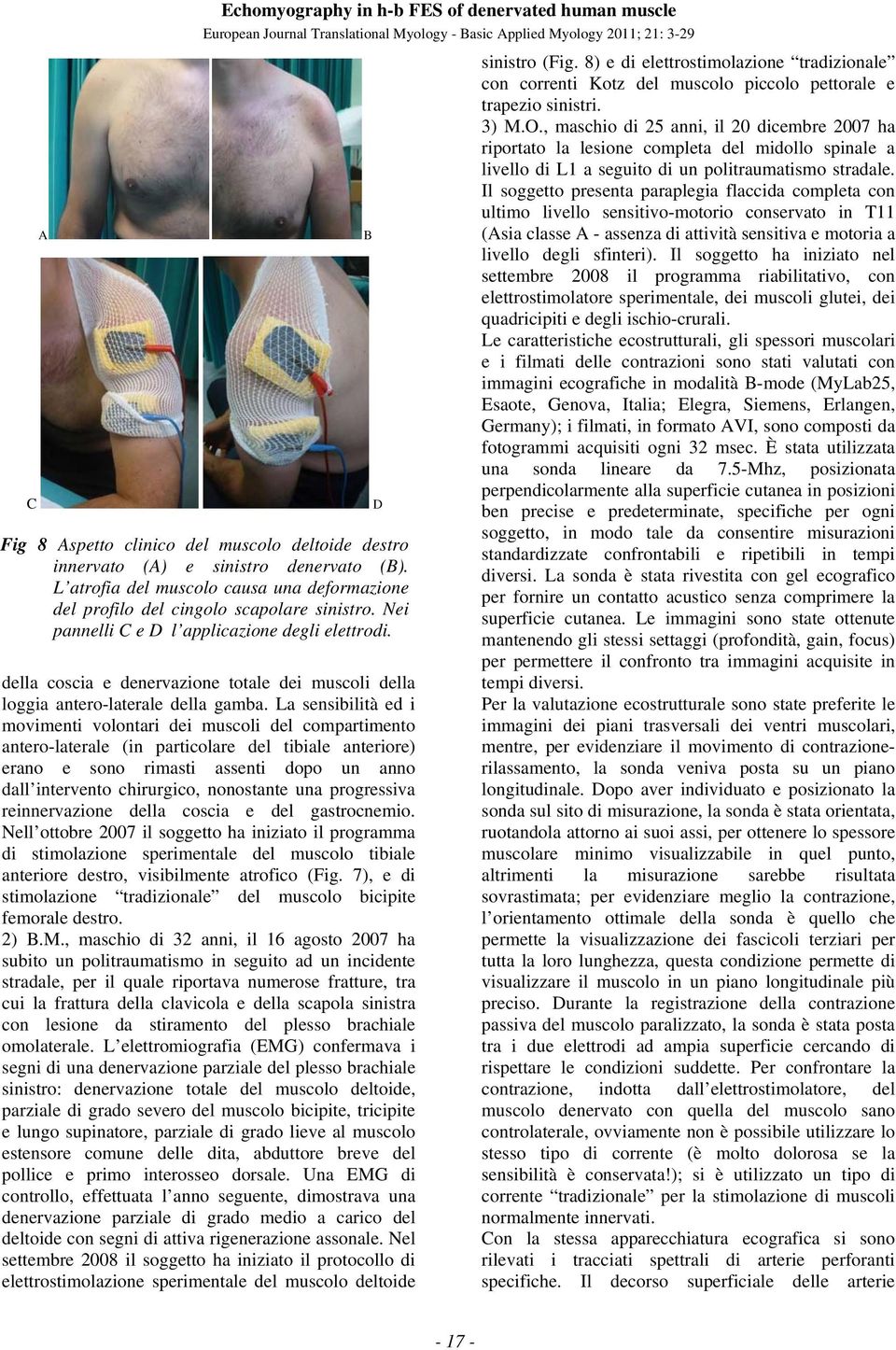 della coscia e denervazione totale dei muscoli della loggia antero-laterale della gamba.