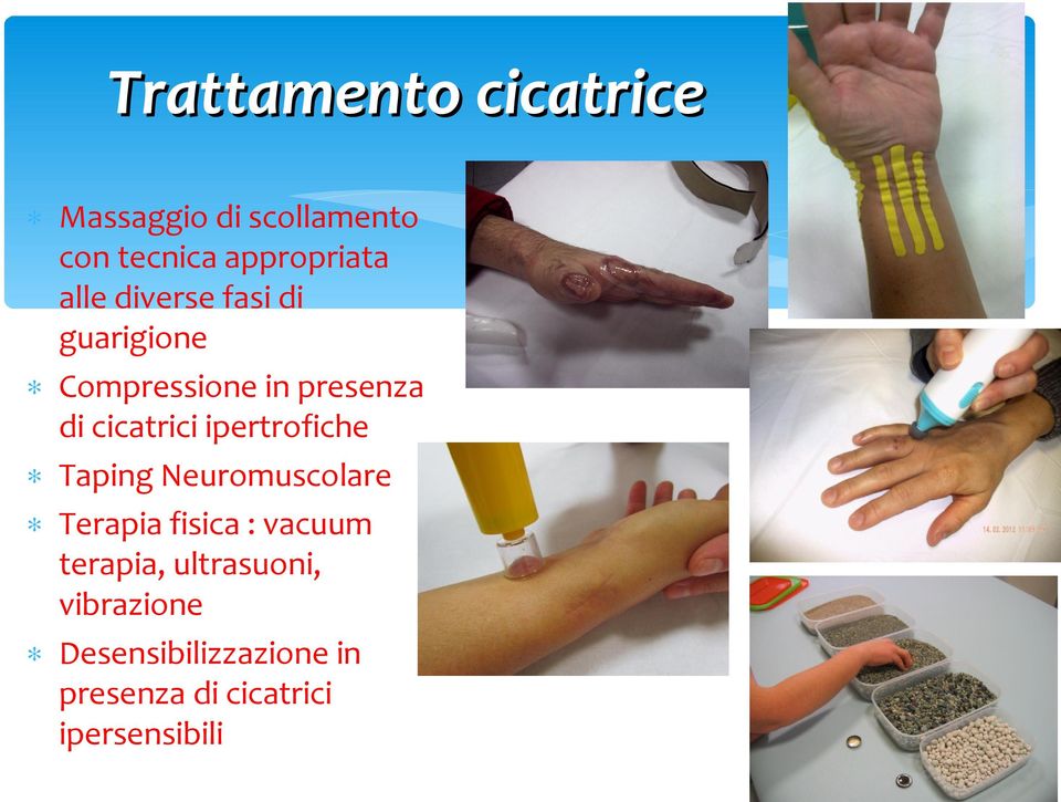 ipertrofiche Taping Neuromuscolare Terapia fisica : vacuum terapia,