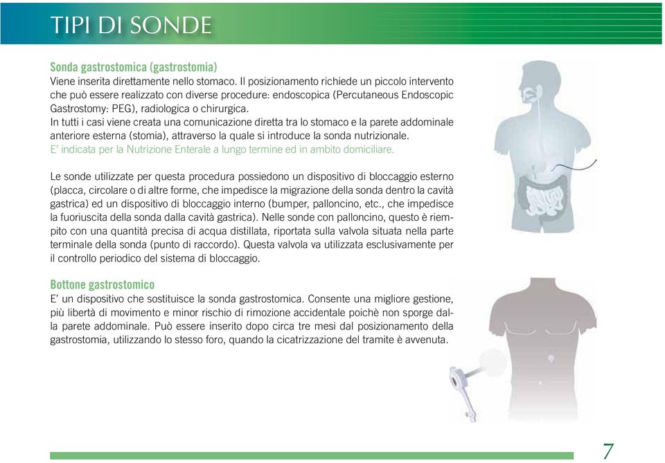 In tutti i casi viene creata una comunicazione diretta tra lo stomaco e la parete addominale anteriore esterna (stomia), attraverso la quale si introduce la sonda nutrizionale.