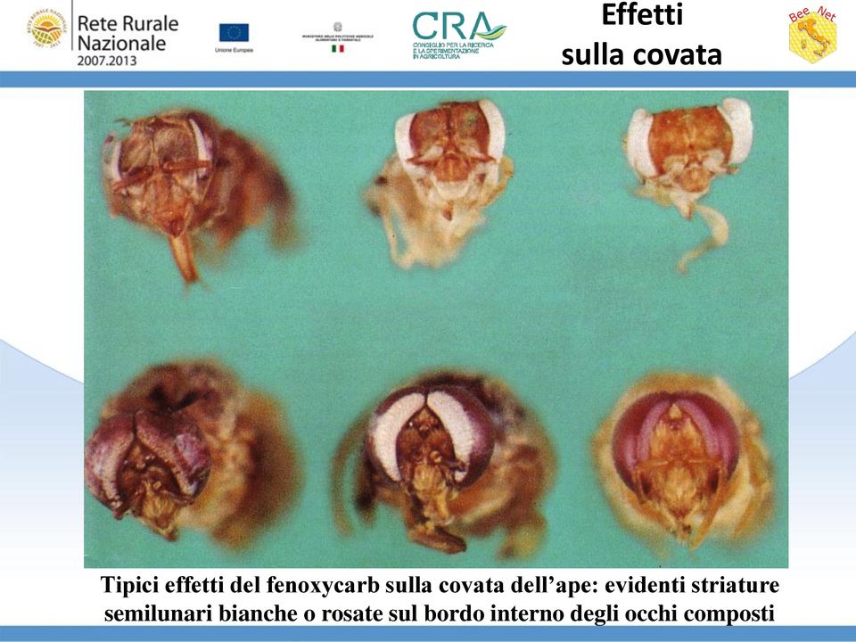 evidenti striature semilunari bianche o