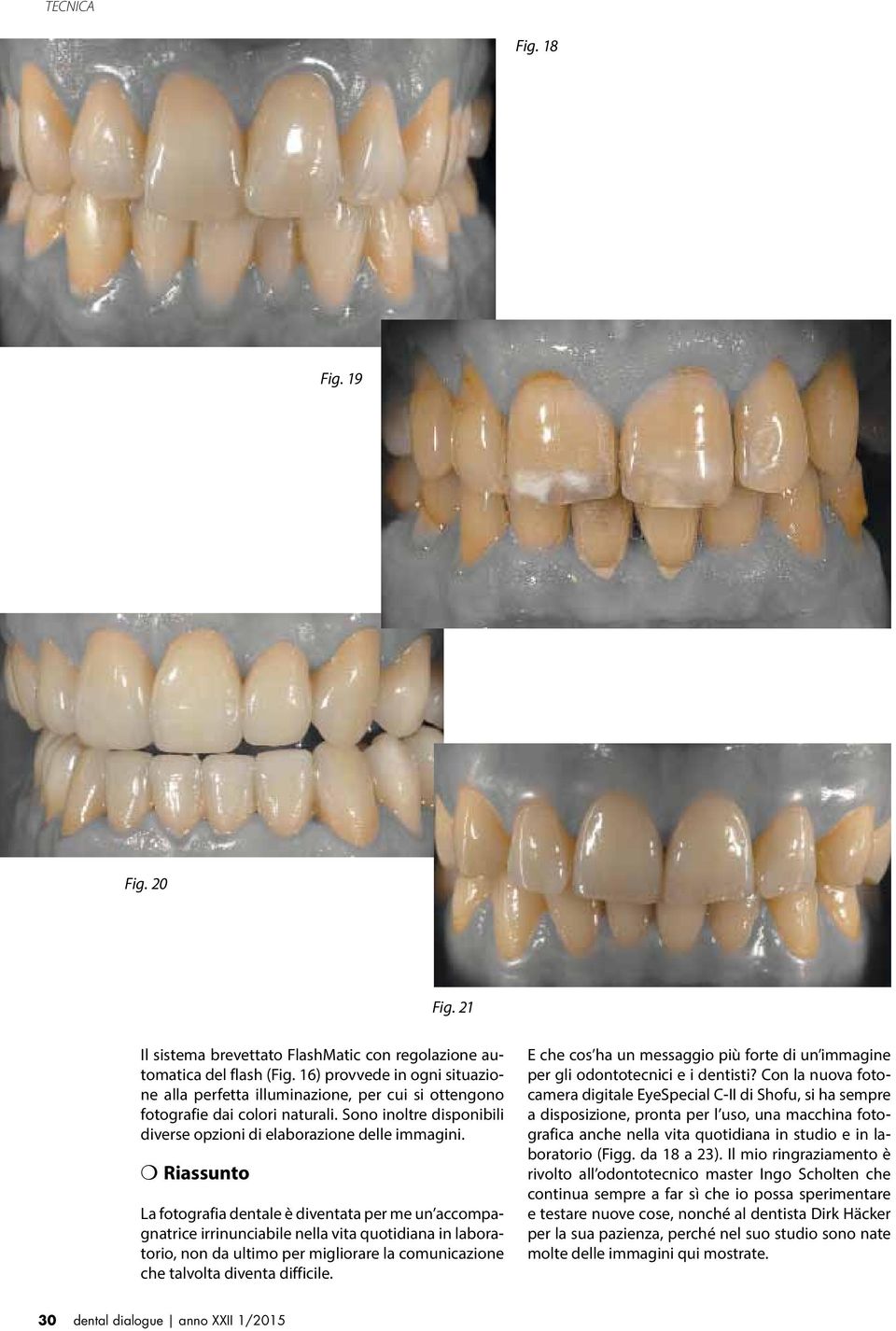 m Riassunto La fotografia dentale è diventata per me un accompagnatrice irrinunciabile nella vita quotidiana in laboratorio, non da ultimo per migliorare la comunicazione che talvolta diventa