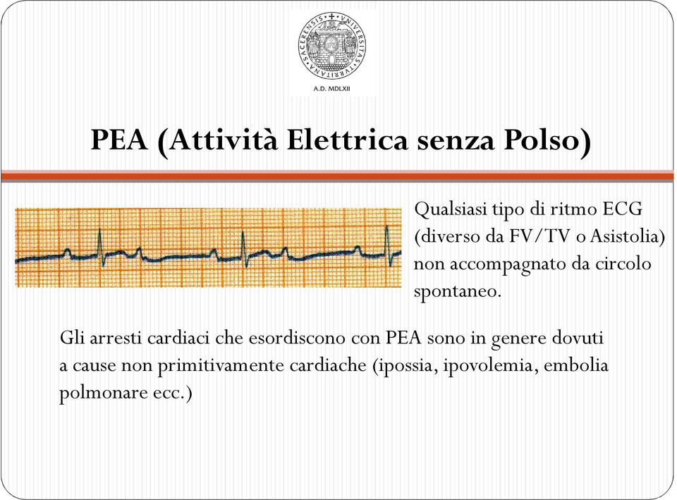 Gli arresti cardiaci che esordiscono con PEA sono in genere dovuti a