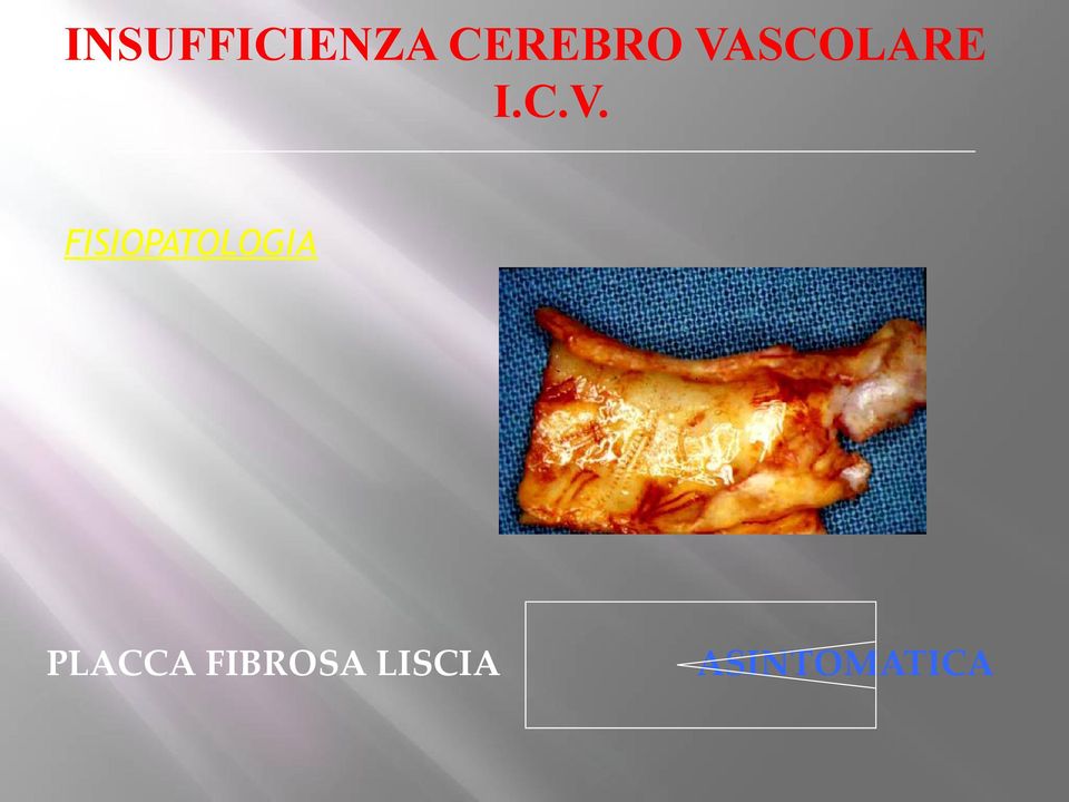 FISIOPATOLOGIA PLACCA