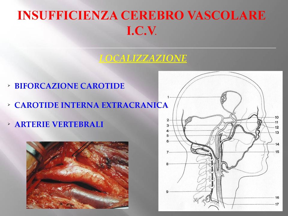 LOCALIZZAZIONE Ø BIFORCAZIONE