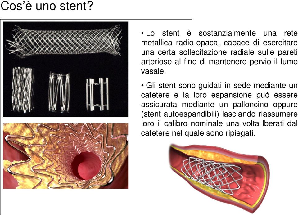 radiale sulle pareti arteriose al fine di mantenere pervio il lume vasale.