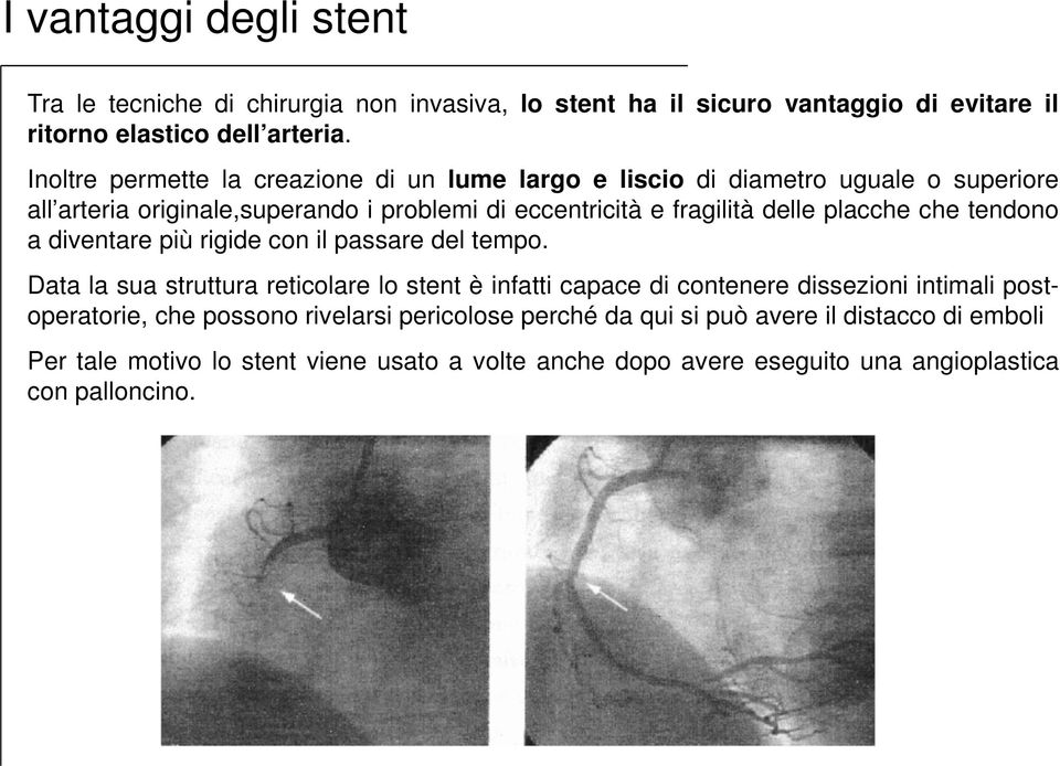 placche che tendono a diventare più rigide con il passare del tempo.