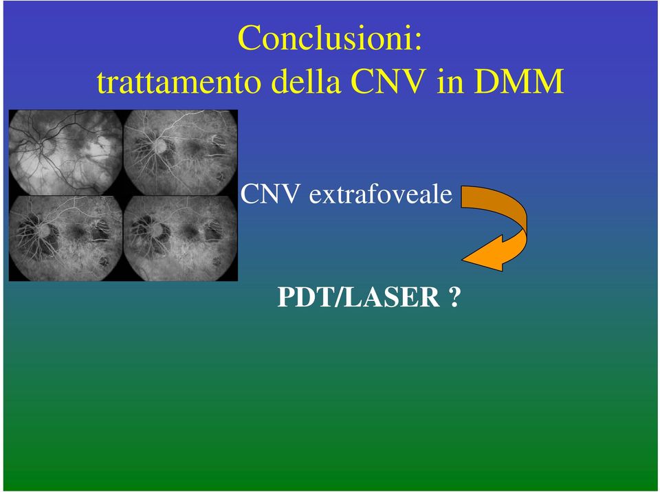 CNV in DMM CNV