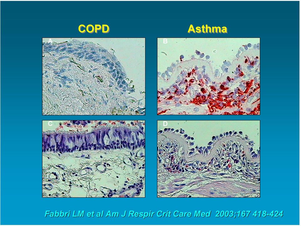 J Respir Crit Care