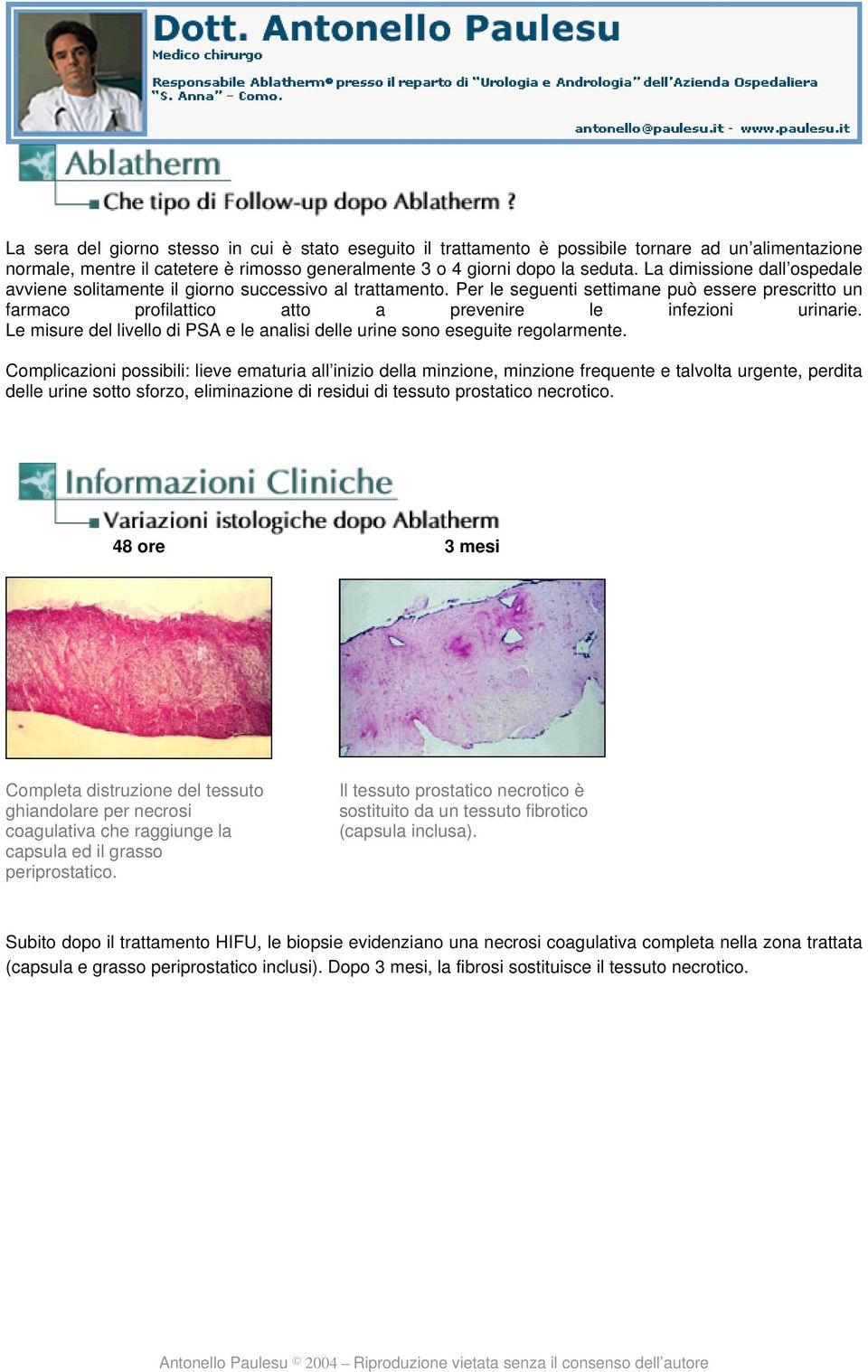 Le misure del livello di PSA e le analisi delle urine sono eseguite regolarmente.