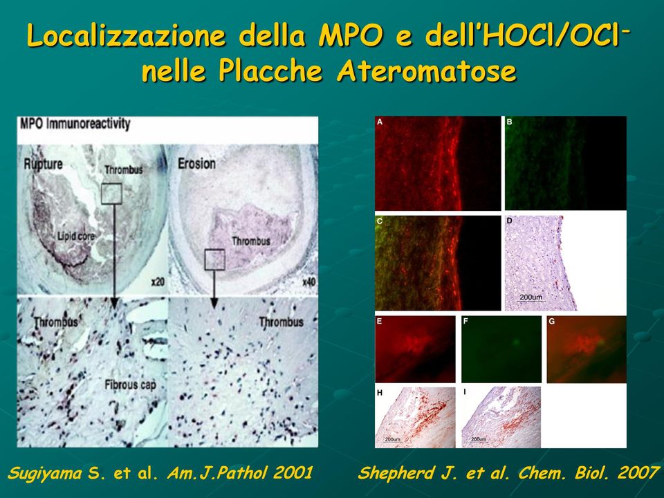 Ateromatose Sugiyama S. et al. Am.