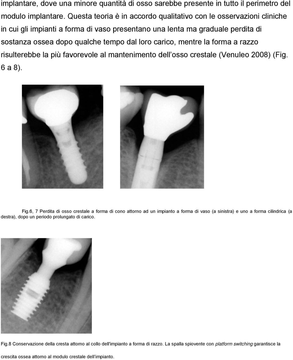 mentre la forma a razzo risulterebbe la più favorevole al mantenimento dell osso crestale (Venuleo 2008) (Fig. 6 a 8). Fig.