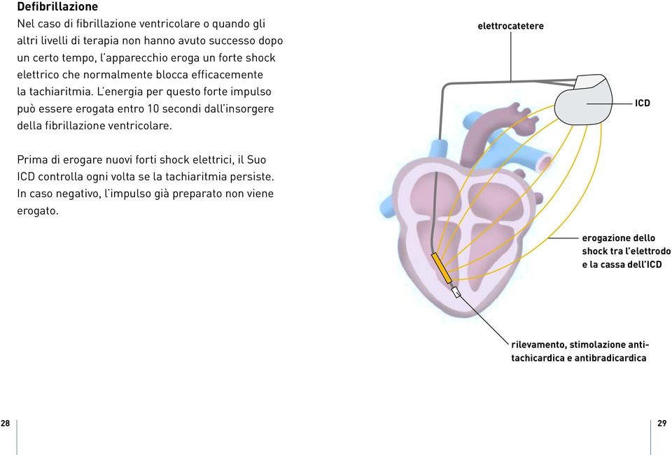 L energia per questo forte impulso può essere erogata entro 10 secondi dall insorgere della fibrillazione ventricolare.