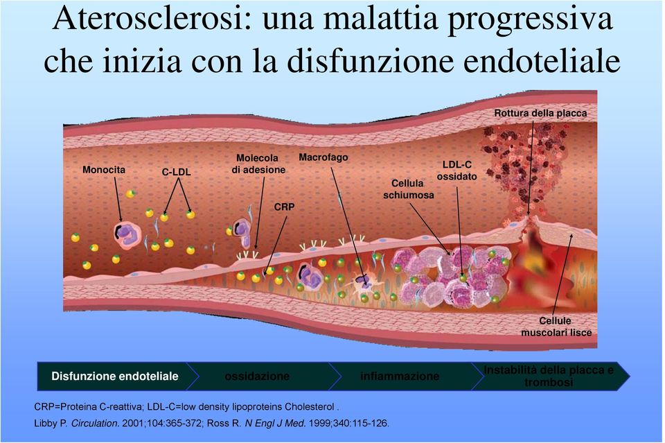 Disfunzione endoteliale ossidazione infiammazione Instabilità della placca e trombosi CRP=Proteina C-reattiva;