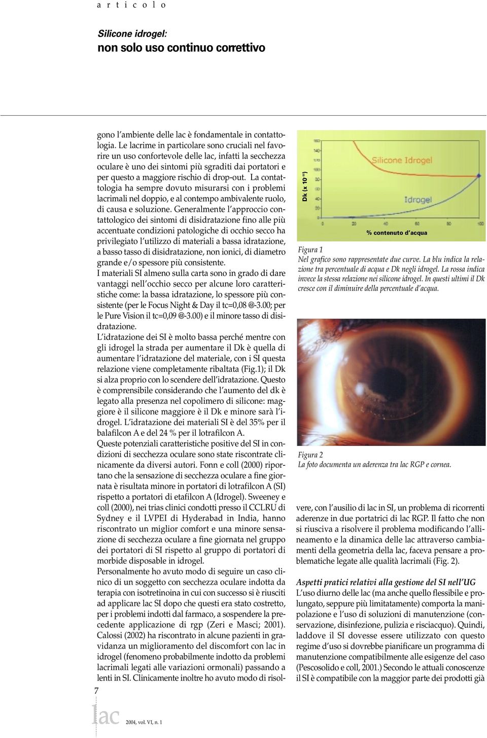 In questi ultimi il Dk cresce con il diminuire della percentuale d acqua. Figura 2 La foto documenta un aderenza tra lac RGP e cornea. gono l ambiente delle lac è fondamentale in contattologia.