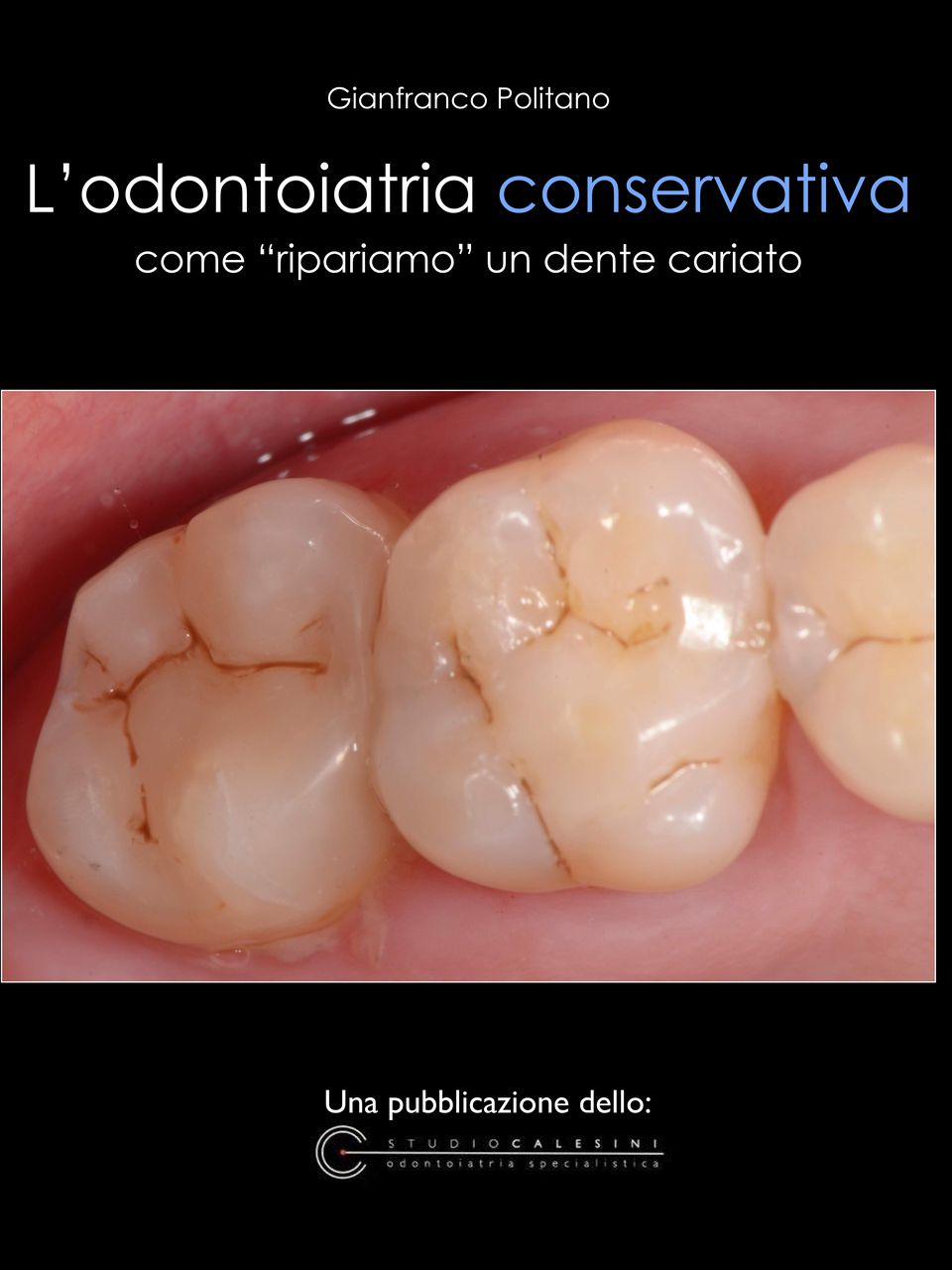 come ripariamo un dente