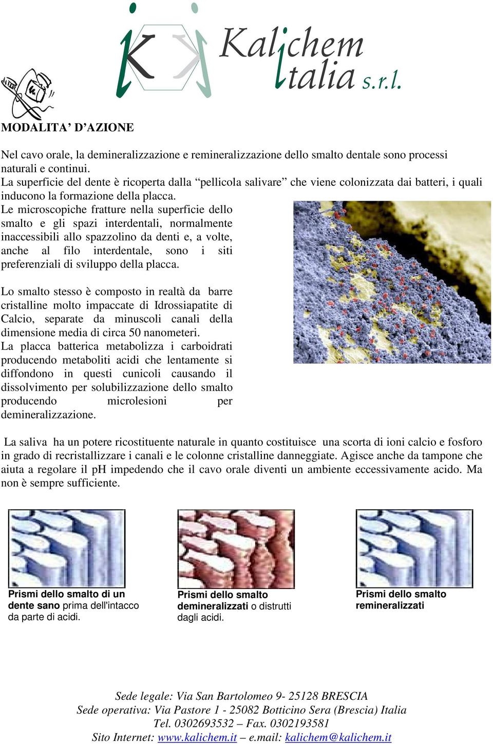 Le microscopiche fratture nella superficie dello smalto e gli spazi interdentali, normalmente inaccessibili allo spazzolino da denti e, a volte, anche al filo interdentale, sono i siti preferenziali