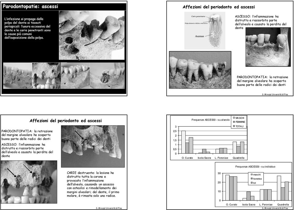 parte dell alveolo e causato la perdita del dente Affezioni del periodonto ed ascessi 3 2,5 2 1,5 1,5 MASCHI Frequenze ASCESSI - su alveolo FEMMINE TOTA LI Frequenze ASCESSI - su individuo CARIE