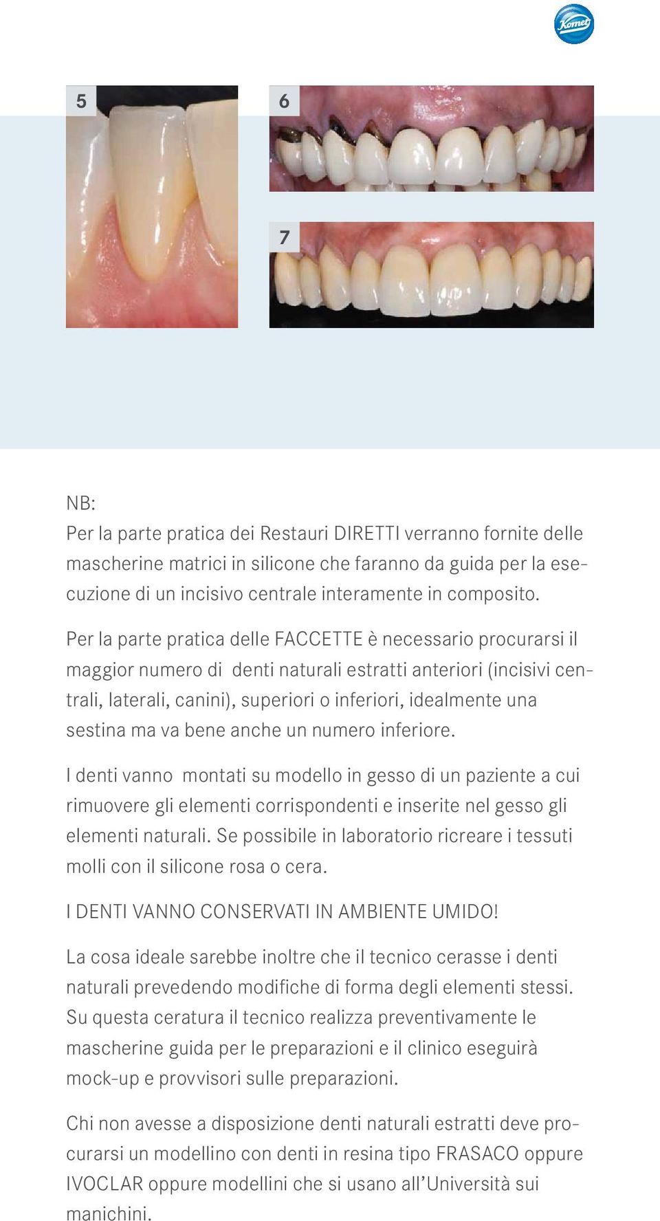 ma va bene anche un numero inferiore. I denti vanno montati su modello in gesso di un paziente a cui rimuovere gli elementi corrispondenti e inserite nel gesso gli elementi naturali.